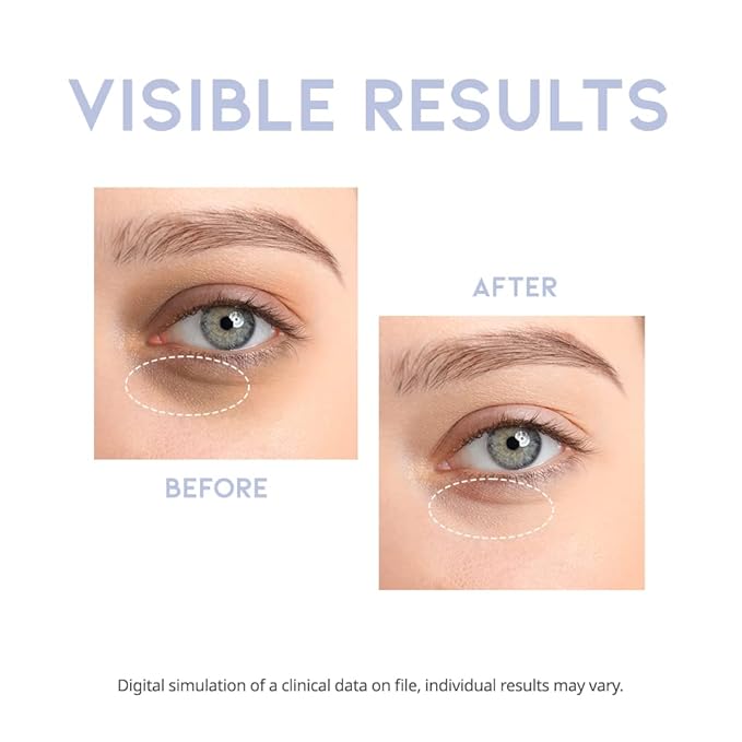 Intensive Eye Serum #OOTD – 1.05 FL OZ – Made in Korea