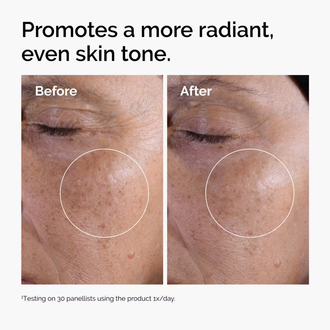 The Ordinary Solución Tónica con Ácido Glicólico al 7% - Ulta Beauty
