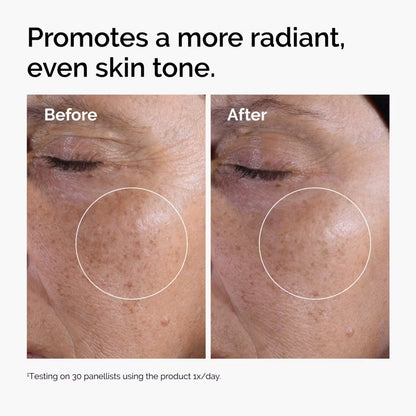 The Ordinary Solución Tónica con Ácido Glicólico al 7% - Ulta Beauty